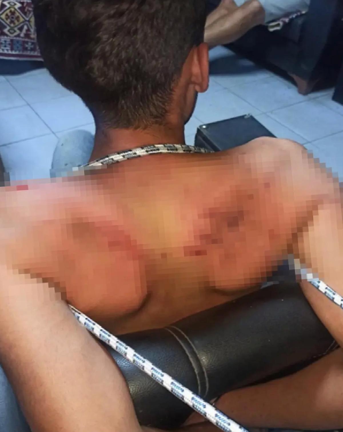 Antalya’da İşkence Davası Devam Ediyor