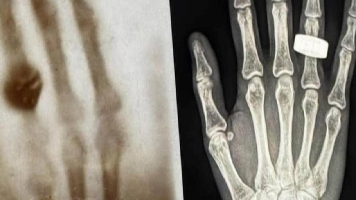 Astronotlar uzayda llk röntgeni çekti: Peki bu neden önemli
