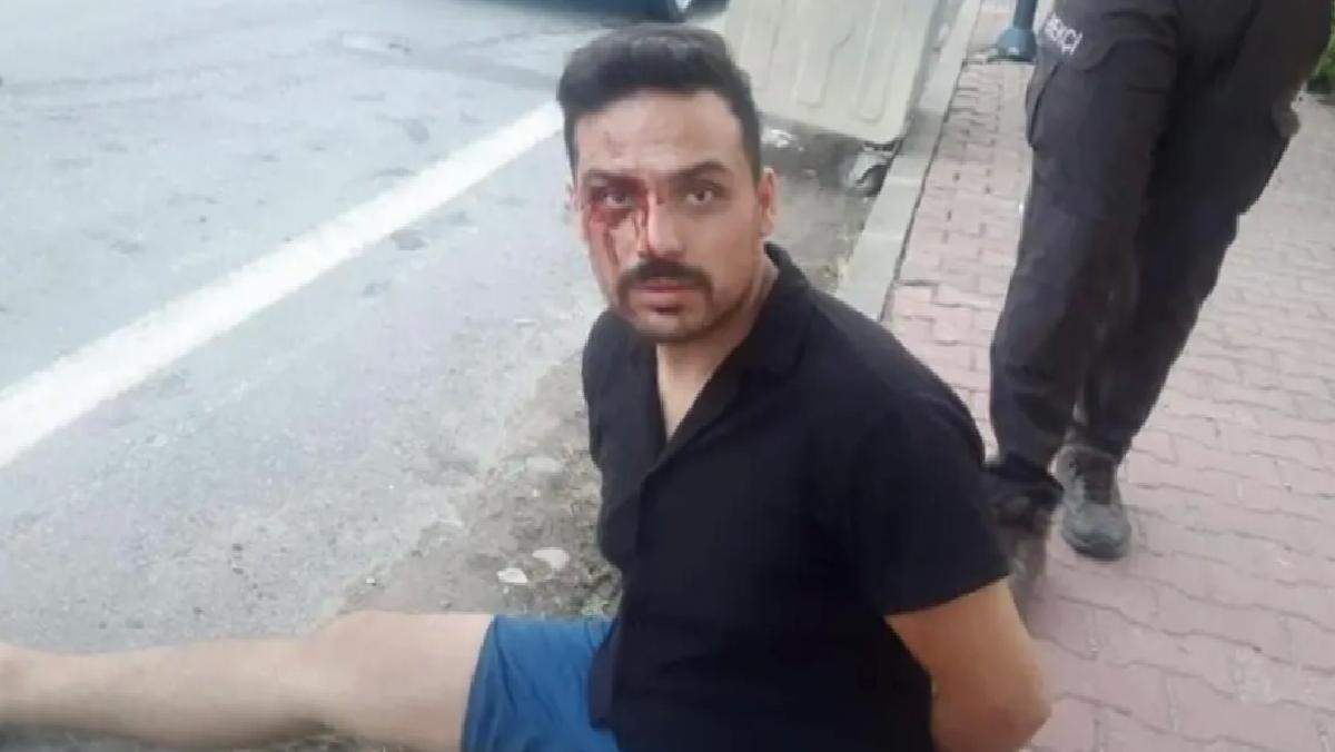 Boşanma Aşamasındaki Eşine Ateş Açtı