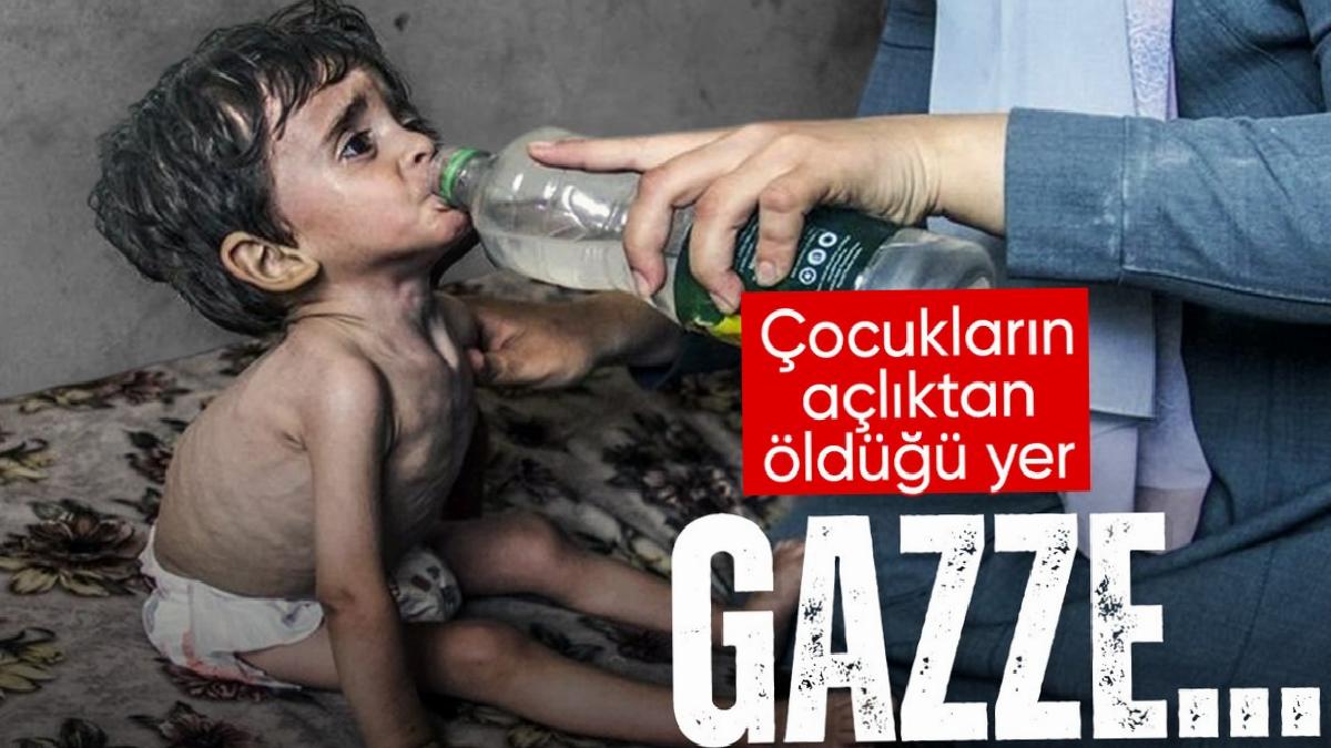 Gazze’de 52 çocuk açlıktan öldü