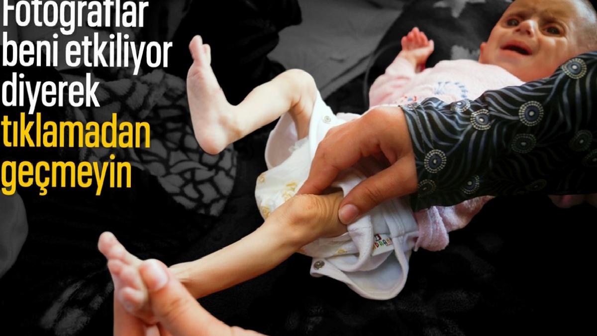 Gazze’de acı tablo: Açlık krizi derinleşiyor