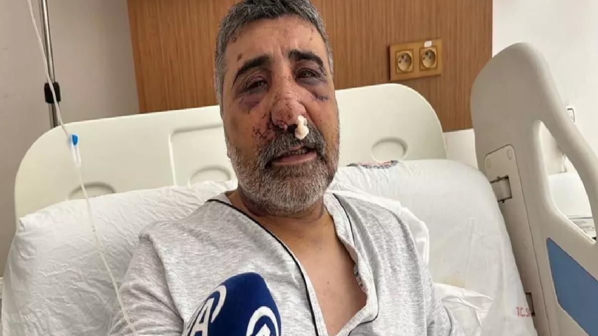 İngiliz Boksör Taksi Şoförünü Darbetti
