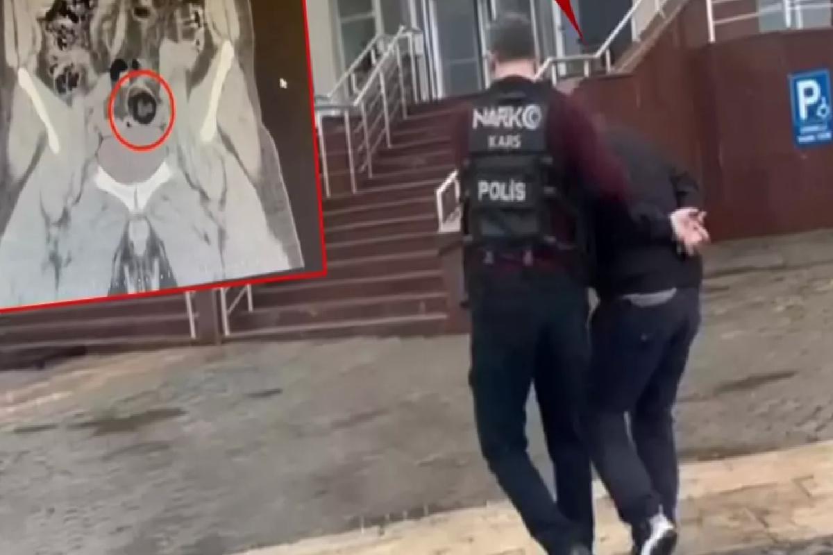 İranlı yolcunun makatından uyuşturucu çıktı