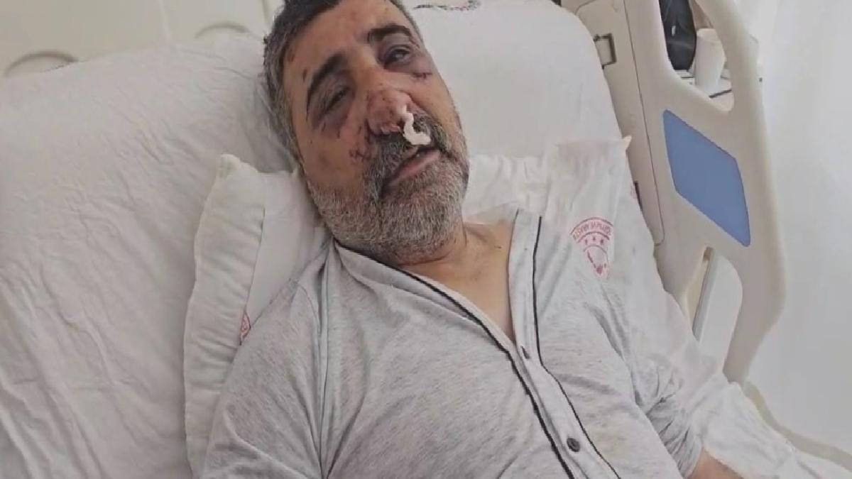 İstanbul’da İngiliz boksörün darbettiği taksici konuştu