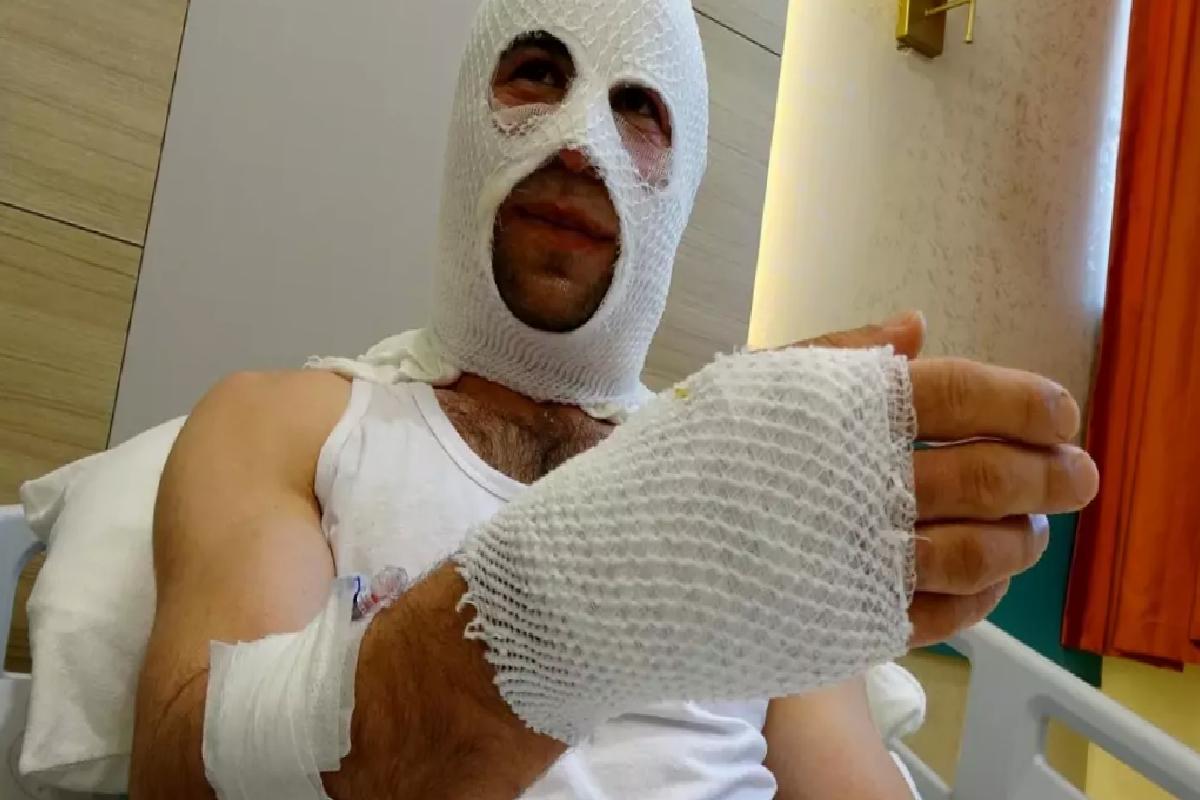Nişanlısına hediye hazırlarken sprey boya kutusu patladı, hastanelik oldu