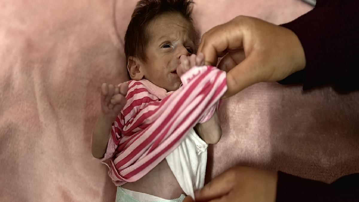 Gazze’de bir bebek daha açlık yüzünden can vermek üzere