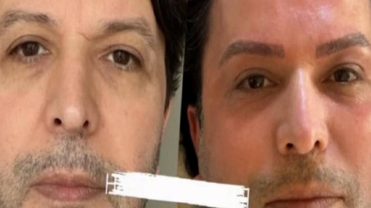 Nihat Doğan estetik işlem yaptırdı